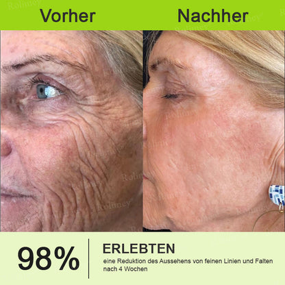 Rolimey® Botox & Vita-A Retinol Shot Falten-Lift Straffungscreme🇩🇪Jetzt jugendliche Haut zurückgewinnen