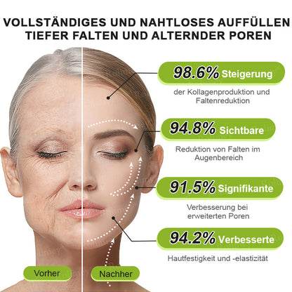 Rolimey® Botox & Vita-A Retinol Shot Falten-Lift Straffungscreme🇩🇪Jetzt jugendliche Haut zurückgewinnen
