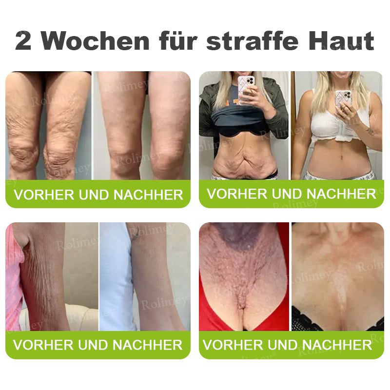 Rolimey® Botox & Vita-A Retinol Shot Falten-Lift Straffungscreme🇩🇪Jetzt jugendliche Haut zurückgewinnen