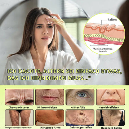 Rolimey® Botox & Vita-A Retinol Shot Falten-Lift Straffungscreme🇩🇪Jetzt jugendliche Haut zurückgewinnen